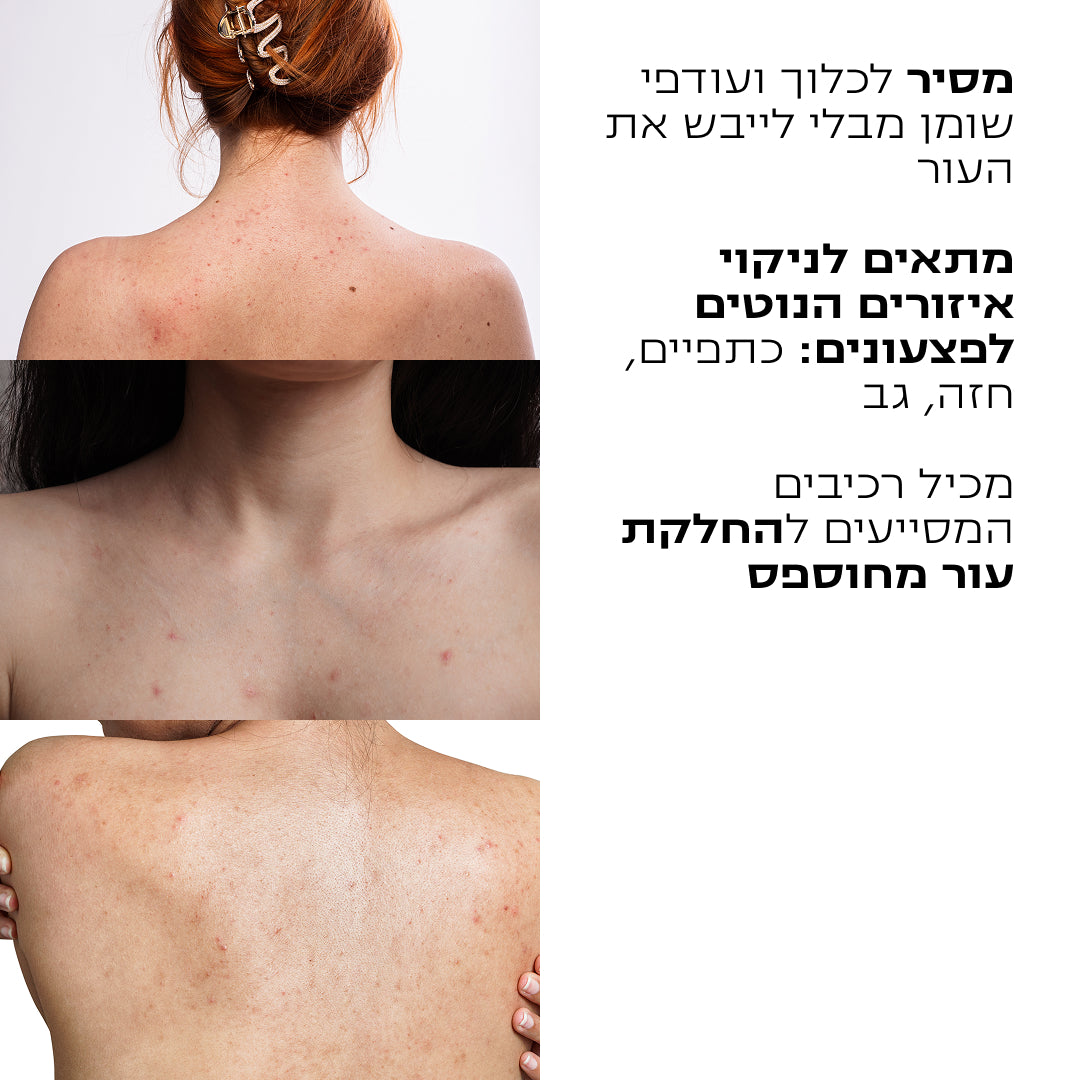 ג'ל רחצה לגוף לעור הנוטה לפצעונים | CLEAR