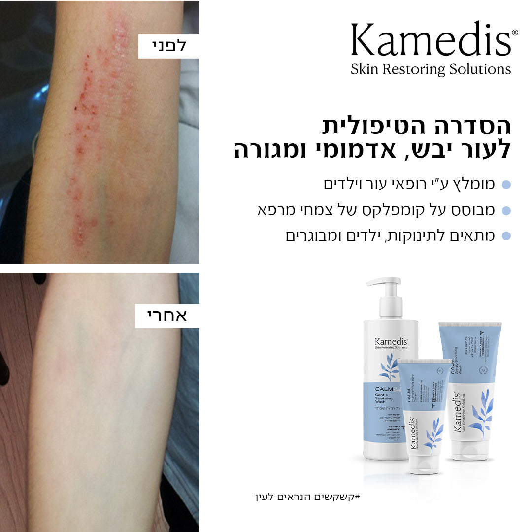 ג'ל רחצה טיפולי להקלה על עור יבש אדמומי ומגורה | CALM