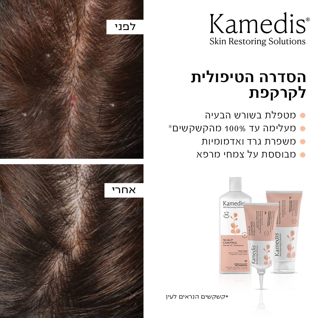 ערכה דו שלבית לטיפול בקשקשים, קרקפת מגרדת ויבשה | SCALP CONTROL